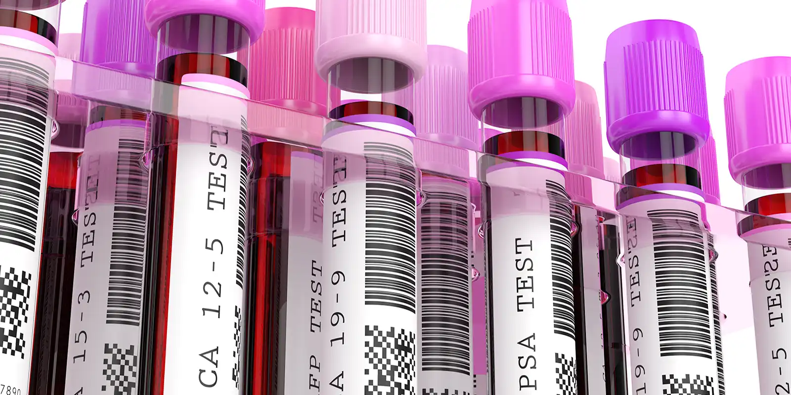 Blood Screening Test
